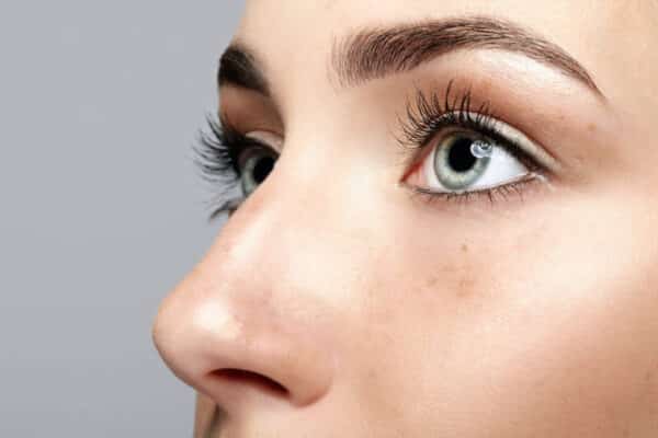 WHAT IS BLEPHAROPLASTY?