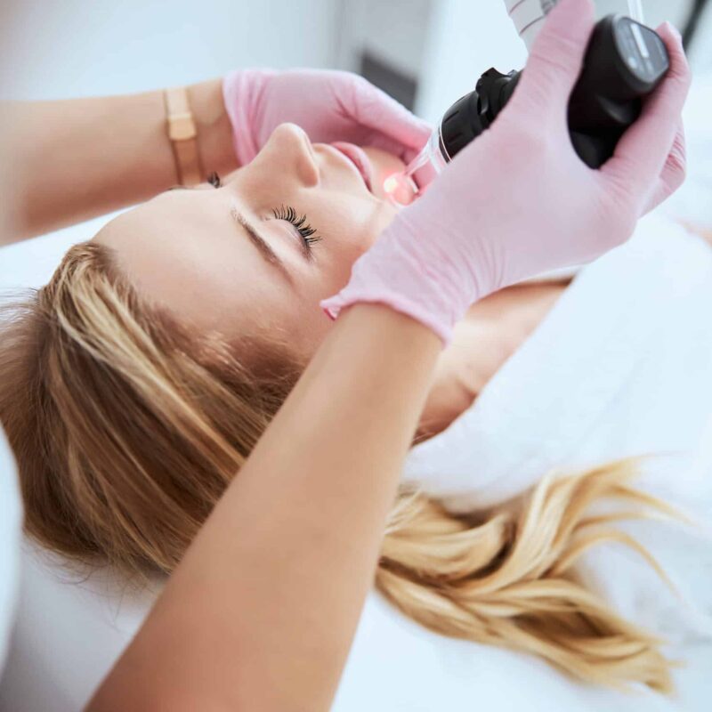 Woman receiving the fractional laser treatment in a beauty salon