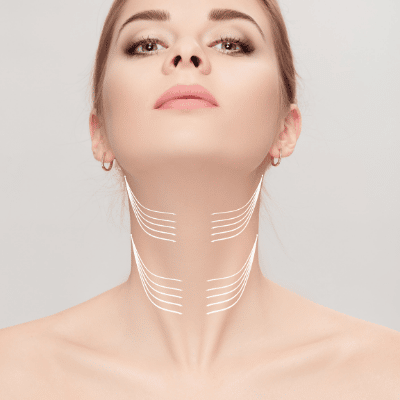doctor drawing liposuction lines for surgery on slim female neck contouring