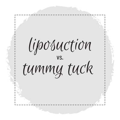liposuction vs tummy tuck