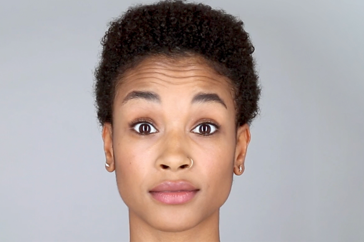 woman before Botox in Newport News & Williamsburg, VA