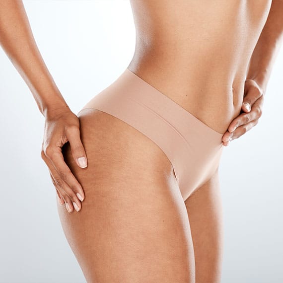 woman after getting a brazilian butt lift in Newport News, VA