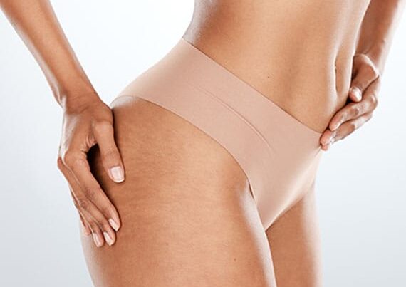 woman after her brazilian butt lift in Newport news, VA