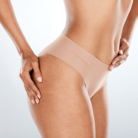 woman after her brazilian butt lift in Newport news, VA