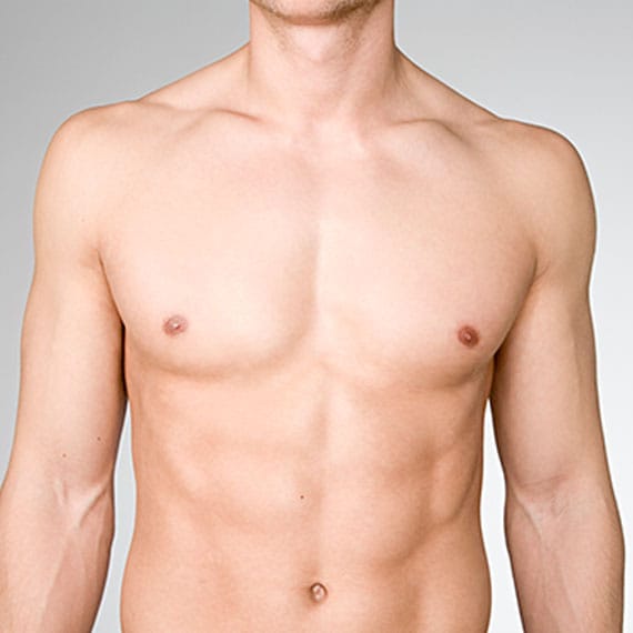 man after getting treatment for his gynecomastia in Williamsburg, VA