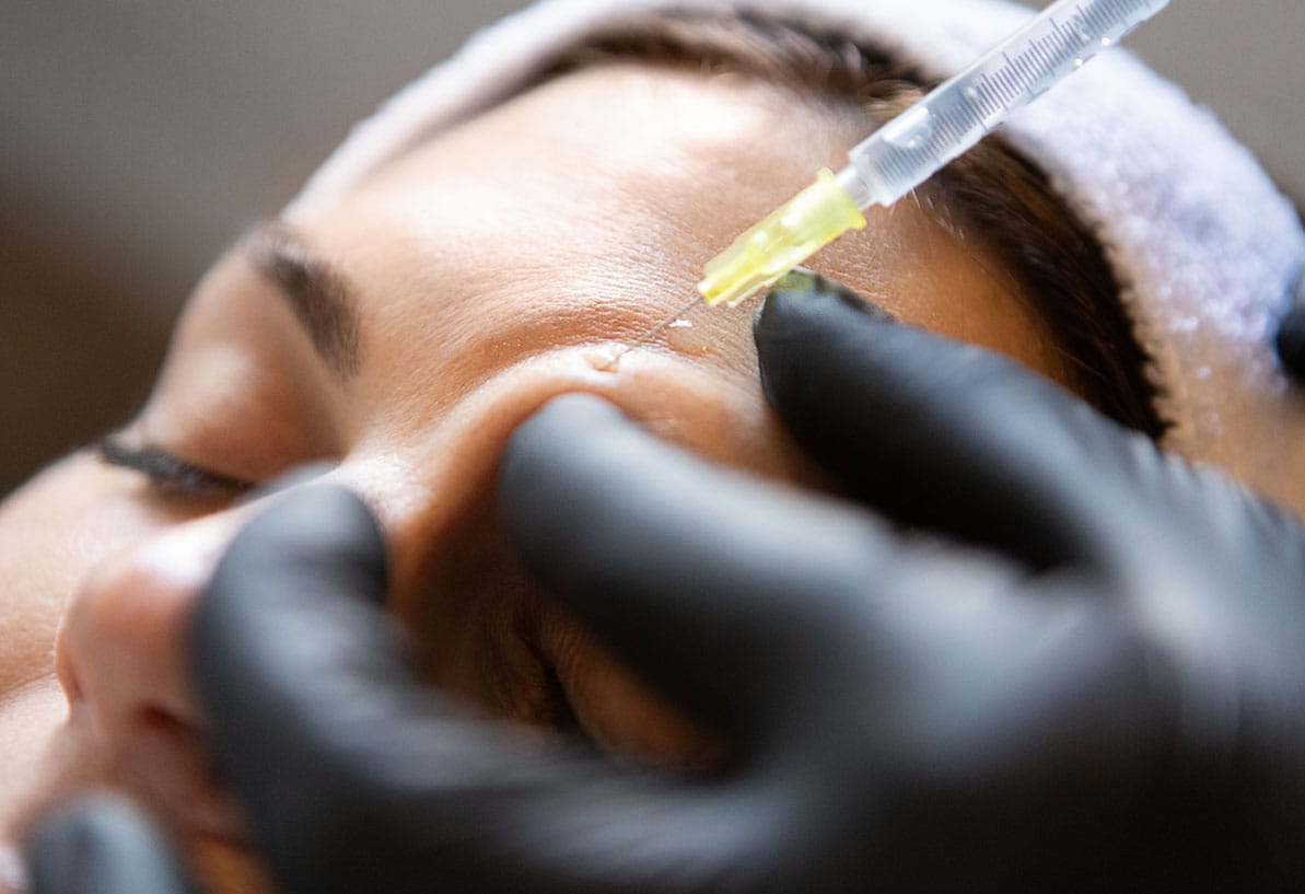woman getting dermal fillers in Newport News, VA
